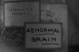 Frankenstein (1931) -- The Abnormal Brain